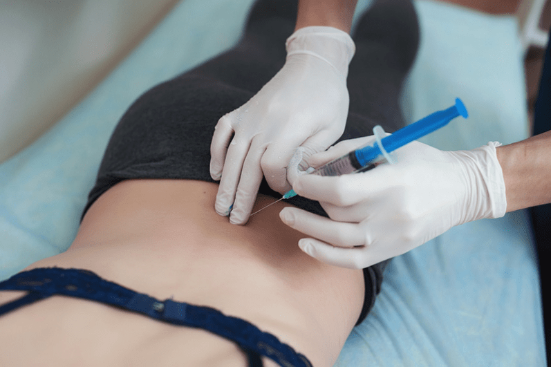 blokád az ágyéki osteochondrosisban